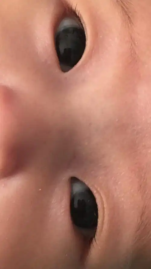 您好我孩子一岁半到两岁时偶尔发现间斜出现频率不算高四岁