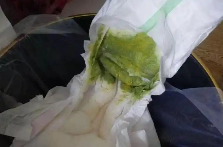 正常情况下,宝宝第一次拉出来的便便,大多是黑色或墨绿色,看着黏黏的