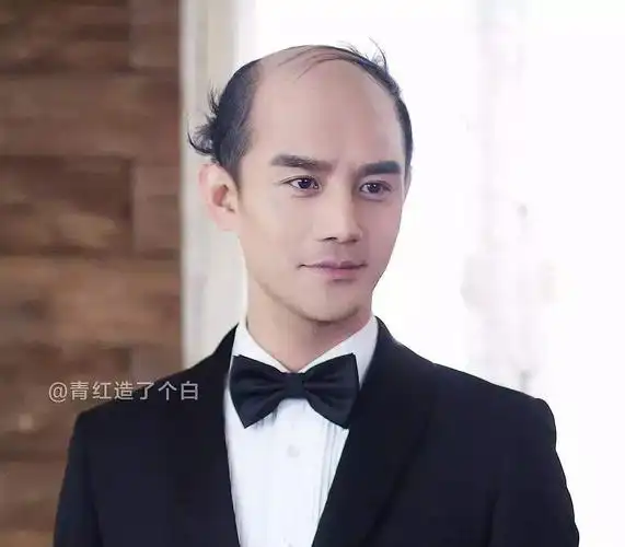 假如当红流量男明星秃顶了,你还爱他们吗