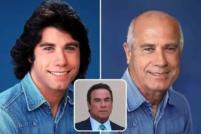 令人唏嘘看看这些整容失败的明星人工智能对比自然老去的样子