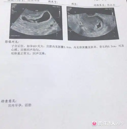 茄子形状的孕囊