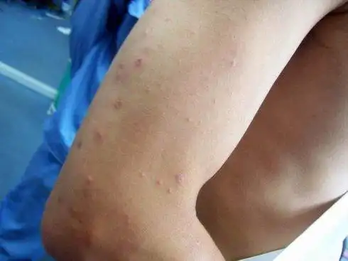 深圳龙岗白蚁防治公司_深圳美乐美科技有限公司_供应信息