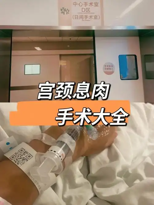 (上)全程记录宫颈息肉手术!为你排忧解难