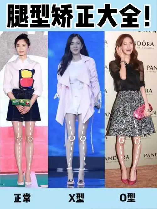 测测你是哪种腿型75腿型矫正方法来啦75