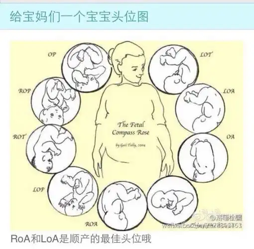 头位是宝宝姿势啦
