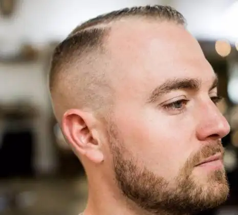 32款男士秃顶发型!