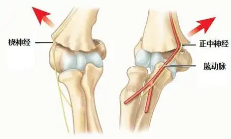 儿童肱骨髁上骨折,这些看片技巧你了解吗?_网易订阅