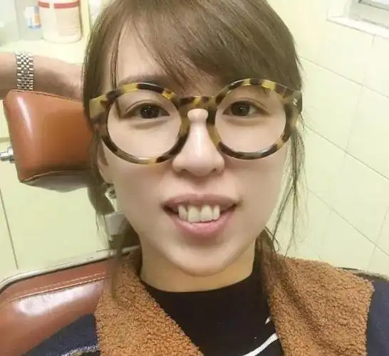 tvb小花为拍新戏扮丑角龅牙造型获网民激赞:太可爱了!