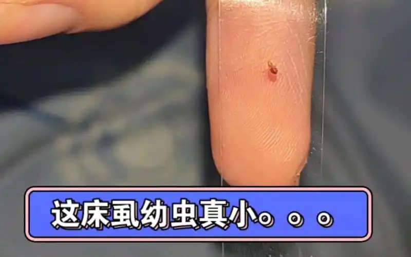 床虱幼虫真小啊