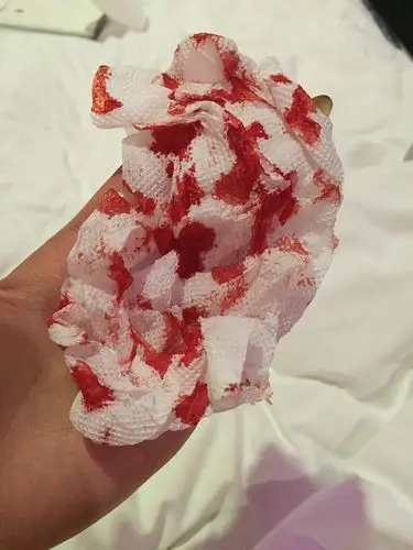 慎入我了个妈呀嘴上很小一个伤口为什么流血流成这样