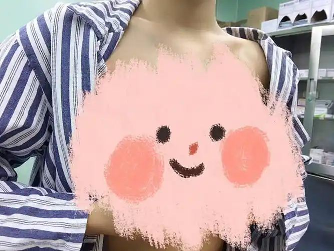 术后即刻看着真的变大了好多90真的不敢相信这是我的胸_圈子-新氧