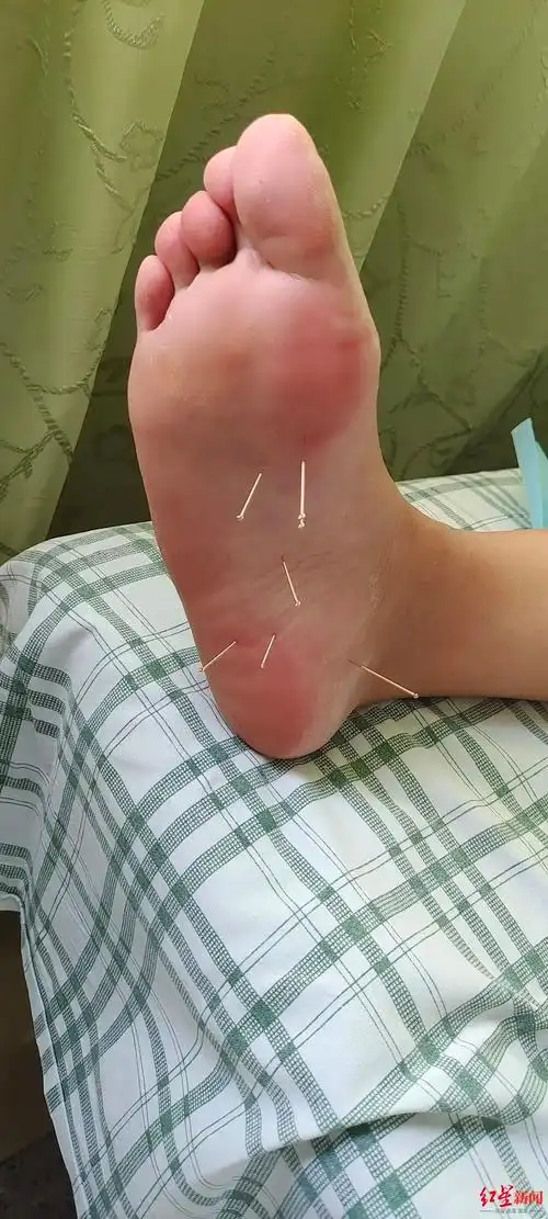 注意长期穿这类鞋易造成足底筋膜炎