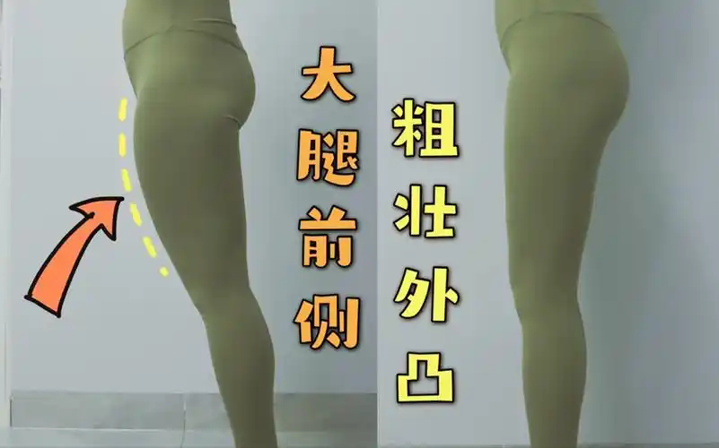 大腿前侧粗壮外凸有赘肉 腿型不直这么练就对了