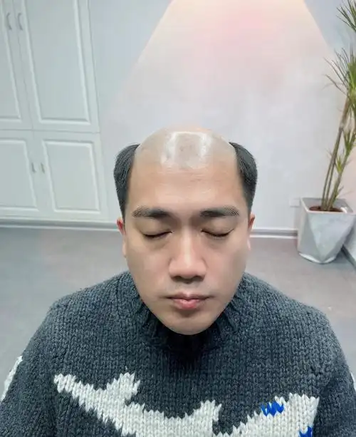 秃头大叔瞬间精神小伙