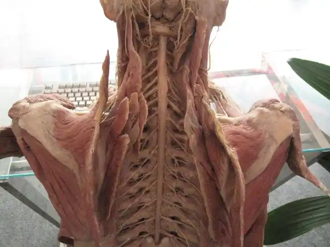 发几张真人解剖的标本照片