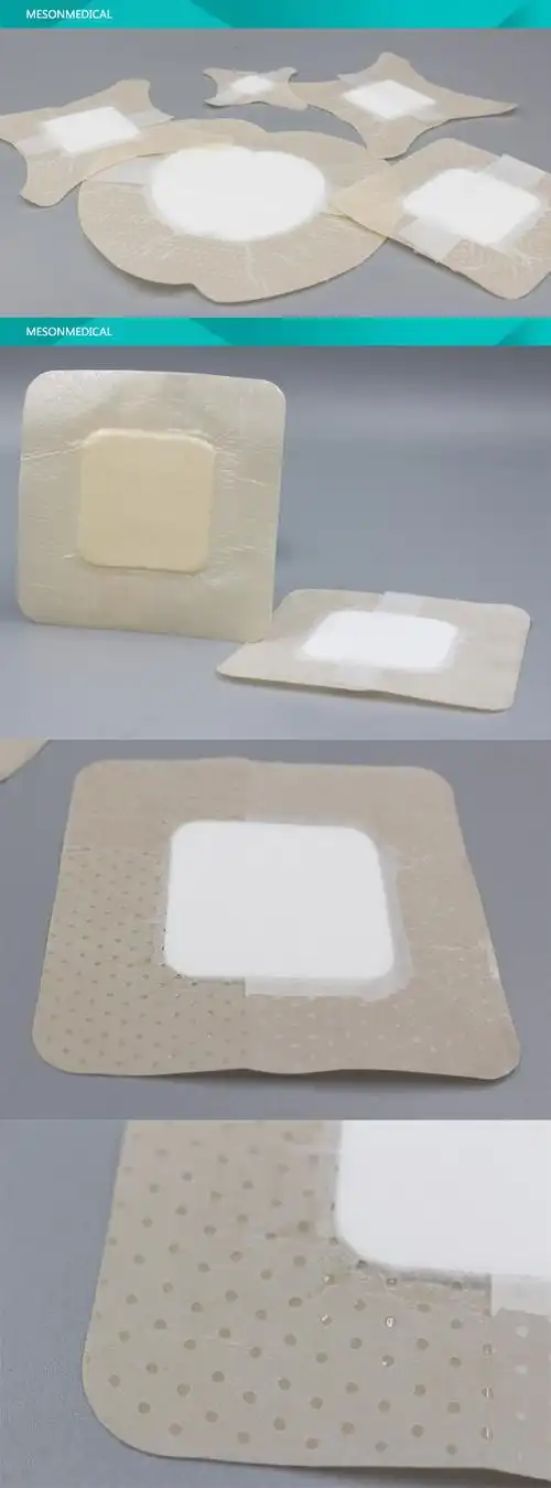 acute and chronic burn bedsore ostomy wound care