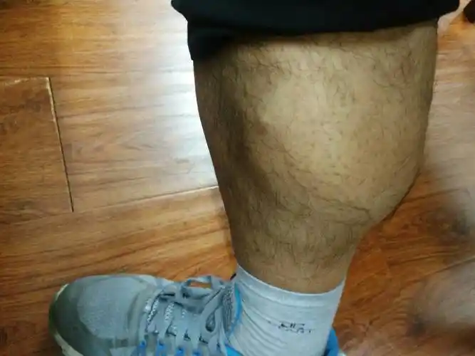 我的小腿肚子太粗了,周长大概在45cm,已每次买裤子对我来说都是一个