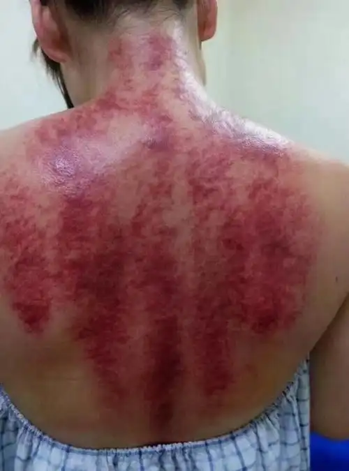 刮痧痛不痛,关键是看你"通不通"