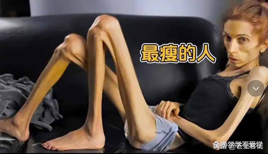 世界上最瘦的几位女人体重仅仅20公斤网友上辈子是干尸吧