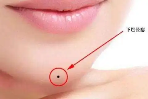 下巴底下长痣好吗富贵荣华有权有势