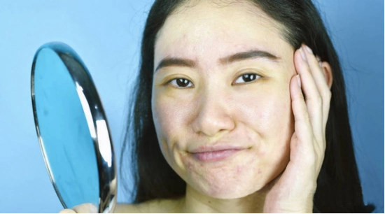 黄褐斑黄脸婆拿什么拯救你奕德堂沉香护肤液救你脱离苦海