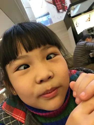 斗鸡眼是这个样子吗?