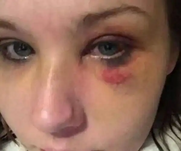 女儿被男友打得鼻青脸肿,丈母娘想找女婿讨说法,不料却爱上女婿