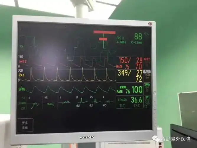 350 mmhg 血压爆表!生死抢救"蜘蛛人"
