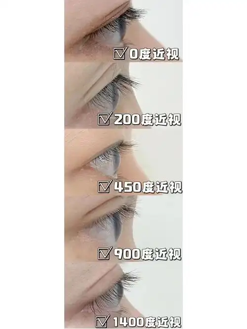 眼镜戴久了眼睛真的会变形?