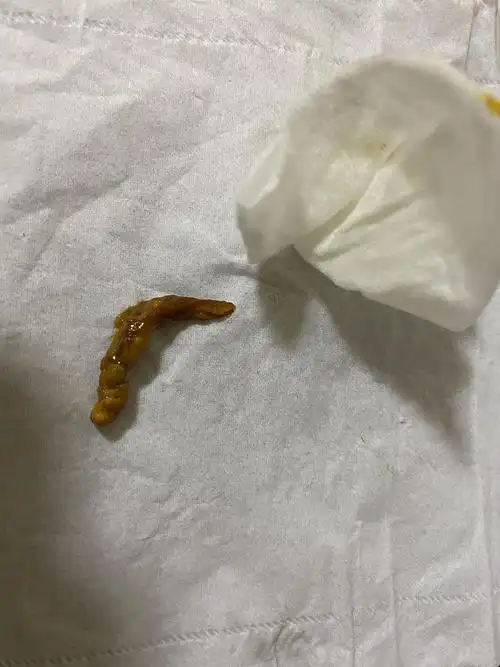 一长坨粑粑,我看着粑粑从菊花里粗来,啊啊啊看得我头皮发麻