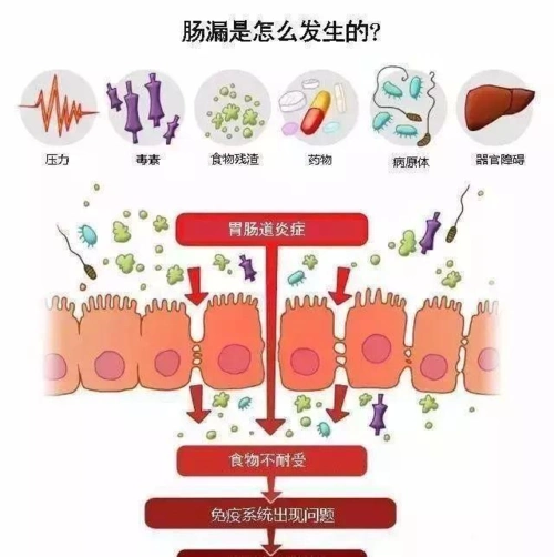为什么桥本患者我让你一定要关注肠道而不先是甲状腺
