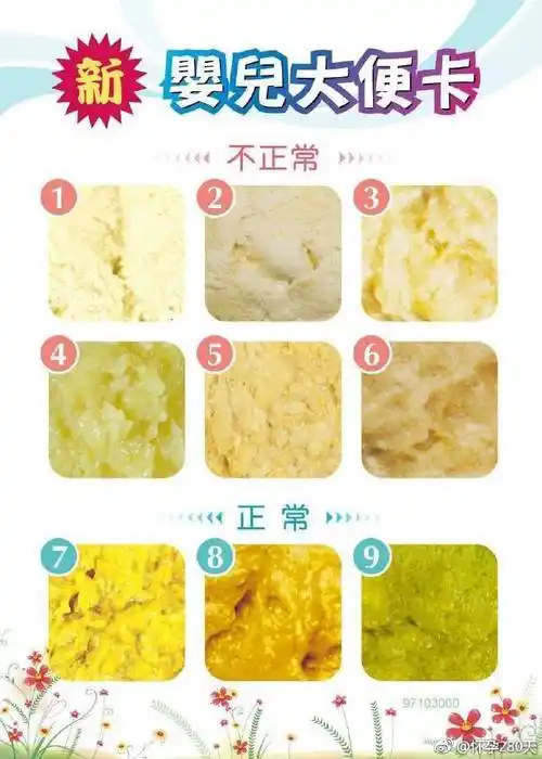 超臭便=食蛋白质多;亮便=食脂肪多;绿便=食铁多(或饥饿性腹泻);蛋花汤