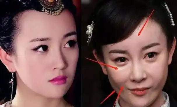 不知道张檬处于什么原因却选择了整容手术,整容后的她与整容前的她