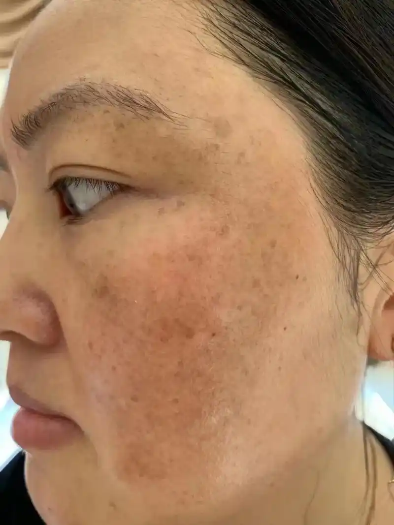 姐妹们,粗黑黄的皮肤怎么能配得上你高贵的气质,斑斑点点的干皮 - 抖