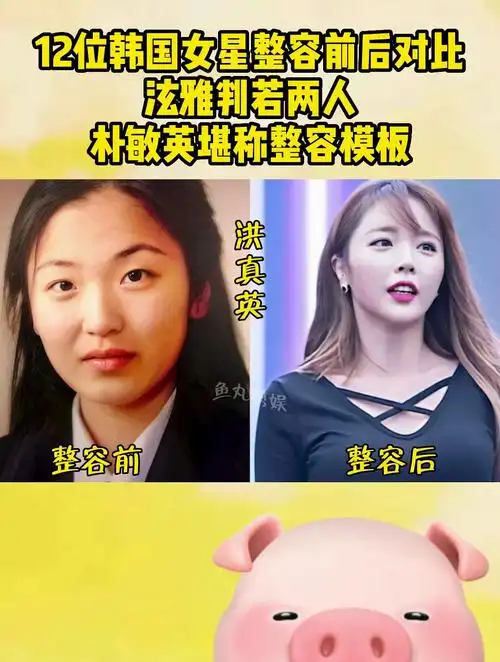 12位韩国女星整容前后对比,泫雅判若两人,朴敏英堪称整容模板-度小视
