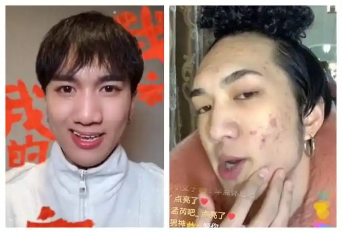 韩佩泉变性和嘴巴唇腭裂有关系吗韩佩泉个人经历简介及家世被扒