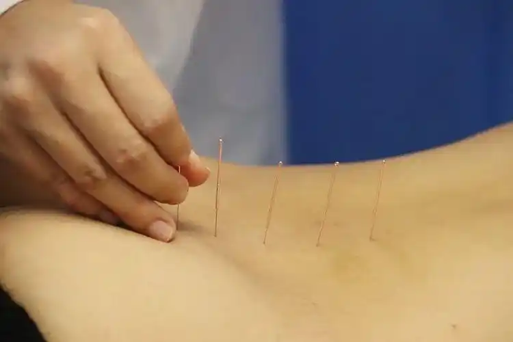 国家级针灸专家加盟罗湖,让"小银针"换来病人的"大健康"