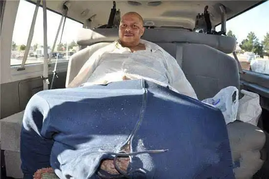 美国拥有世界上最大生殖器的男子因心脏病去世组图