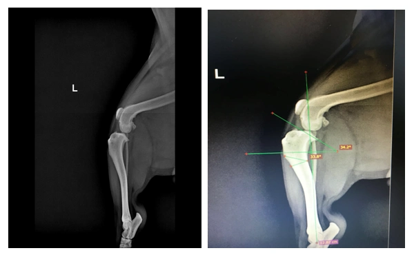 胫骨粗隆有承重感