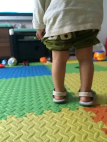 宝宝一岁五个月,这样算o型腿吗?