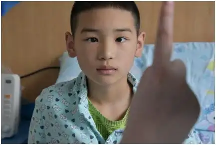 对眼"8年" 男孩终于成功告别斜视