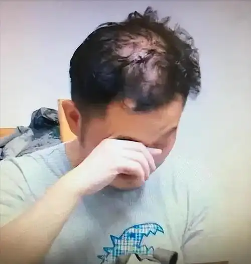 这6位男神中年秃顶,从郑少秋到黄晓明,个个发际线高到离谱!