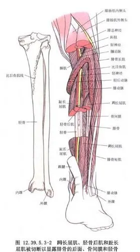 胫骨后肌,腓骨长肌,踇长屈肌腱后置术