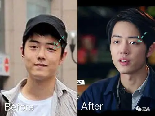 肖战被整形医生石锤换头堪比baby