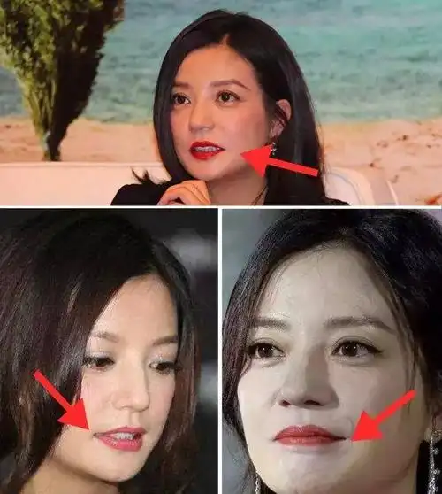 动图里的嘴角下垂也是非常明显. ▽