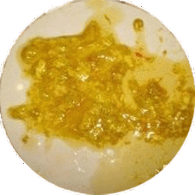 16种婴幼儿异常大便的判断方法,今天的内容捏着鼻子也一定要读完!