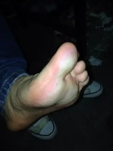 前脚掌发白,请问是怎么了?