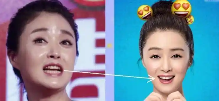 李沁牙齿变白了?