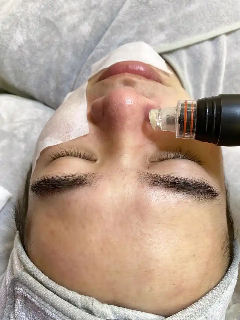 上热门 #深层毛孔清洁 #皮肤管理 可以 - 抖音