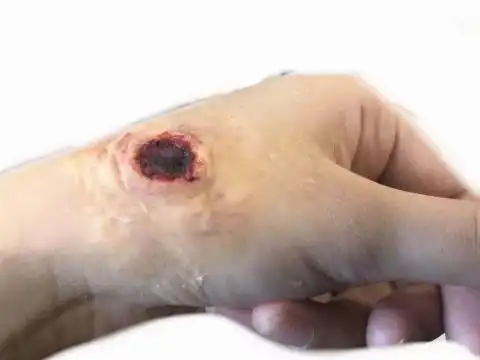 梦见自己中了枪伤